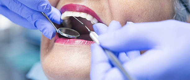 Best Broken Tooth Emergency  in Lake Mary Jane, FL